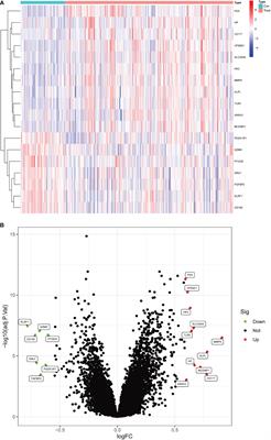 The role of intestinal immune cells and matrix metalloproteinases in inflammatory bowel disease